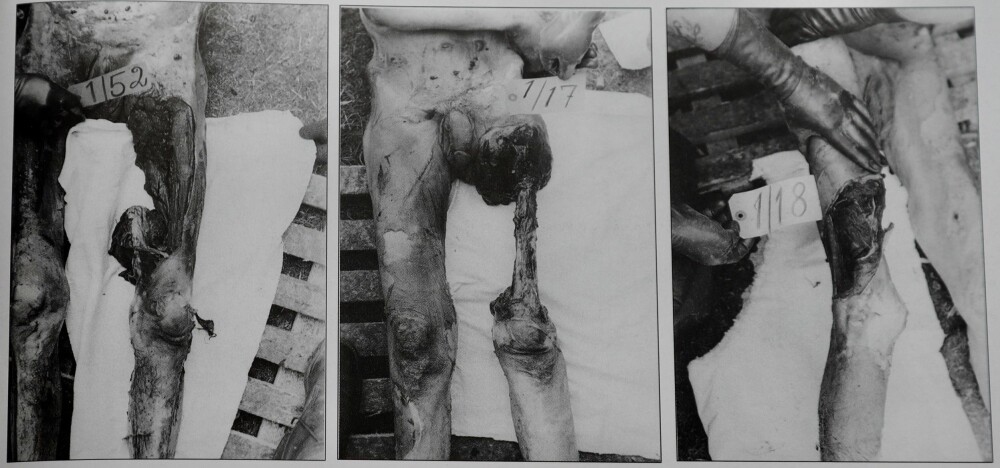 <b><SPAN CLASS=BOLD>OBDUKSJON:</b></span> Tause spor etter redslene fangene ble utsatt for i tyskernes fangeleirer i Storfjord ble avdekket under obduksjonene. Disse sporene viste flere eksempler på kannibalisme.
