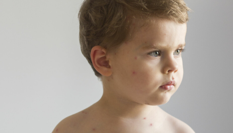 Prikker på barnets hud kan være harmløse, men de kan også bety alvorlig sykdom.