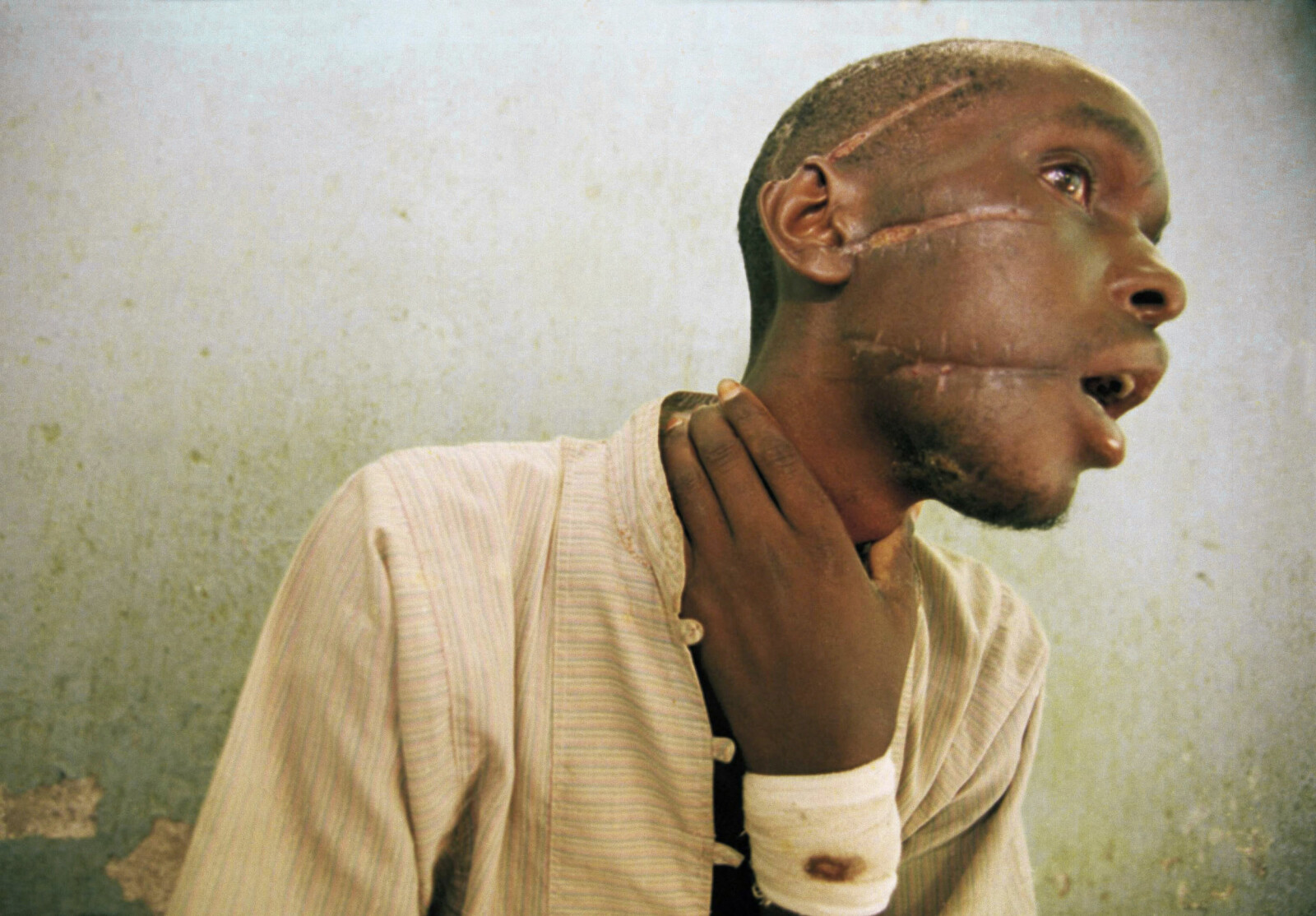 <b>SKAMFERT:</b> For 25 år siden ble Nyabimana funnet alvorlig skadet etter flere machetehugg i Rwanda. Jungelknivens herjinger har inspirert volds­menn over hele verden siden.