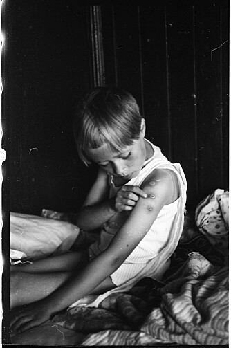 <b>BYL­LER:</b> Man­ge fikk arr et­ter kop­pe­vak­si­nen. Sig­urd Bern­hard Røis­li tok det­te bil­det av lil­le Sig­run et­ter at hun var blitt vak­si­nert i 1939. 