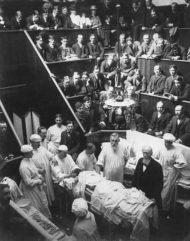 <b>FØRST UTE:</b> Den tyske kirurgen Vincenz Czerny var først ute med å gjennomføre brystforstørrelse. Her et inngrep med publikum til stede.