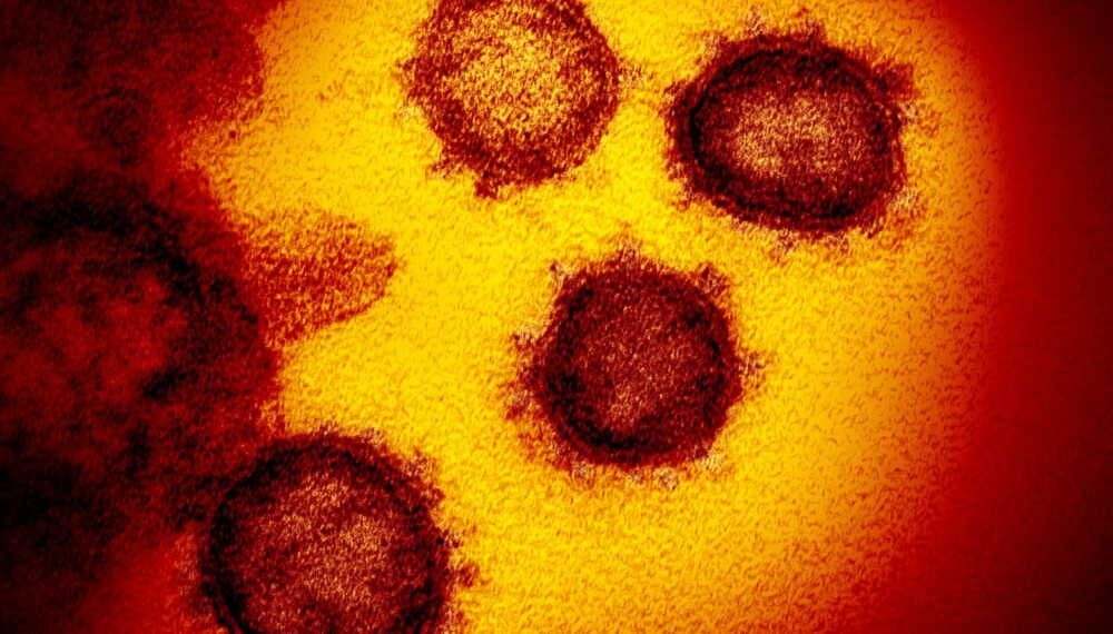 VIRUSRENSING: Korona-viruset møter oss nesten over alt, og da er det viktig å skjerme seg, blant annet ved å redusere smittefaren. Dette er et bilde av SARS-CoV2-2-viruset tatt med elektronmikroskop.