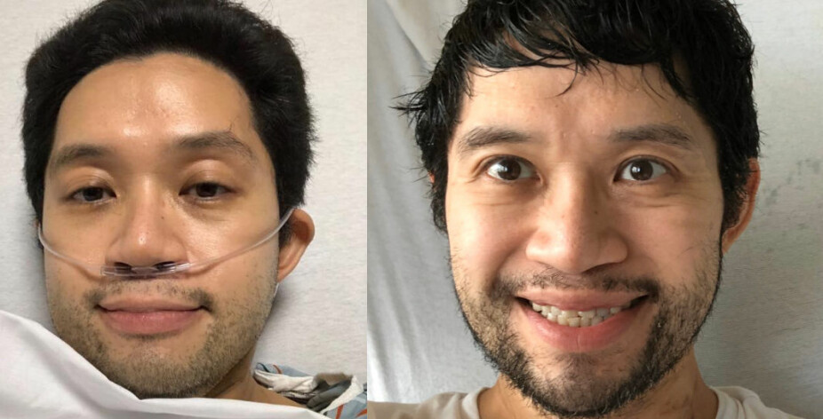 KORONAKAMP PÅ TWITTER: David har twitret flere bilder fra sykesengen. Bildet til venstre er tatt mens han fikk oksygen 17. mars. Bildet til høyre er tatt 1. april da han skulle utskrives.
