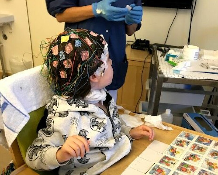 MANGE UNDERSØKELSER: Epileptisk aktivitet i hjernen kan registreres ved hjelp av EEG. Saga har måtte venne seg til mange sykehusbesøk.