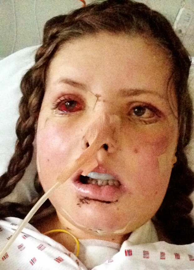 <b>KNUST:</b> Praktisk talt hele ansiktet til Mari ble knust i sykkelulykken.