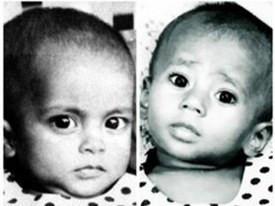 ADOPTERT FRA SAMME STED: Lille Mukta (t.v., omtrent 9 mnd) og Duli for 43 år siden i Dhaka.
