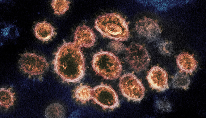 SARS-CoV-2: Et bilde fra et elektronmikroskop viser viruspartikler fra koronaviruset.