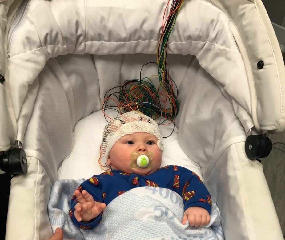 MANGE UNDERSØKELSER: Flere episoder med kramper har gjort at Theo har vært gjennom en rekke EEG-undersøkelser.