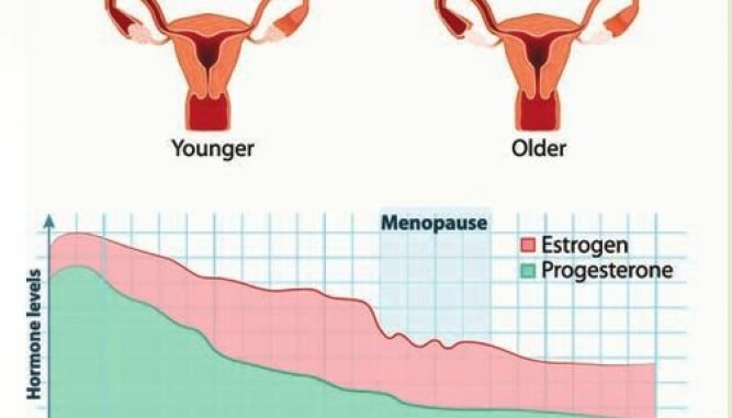 OVERGANGSALDEREN: De fleste kommer i overgangsalderen i 50-årene. Noen av symptomene er redusert sexlyst og tørrhet i skjeden. OVERGANGSALDEREN: De fleste kommer i overgangsalderen i 50-årene. Noen av symptomene er redusert sexlyst og tørrhet i skjeden.