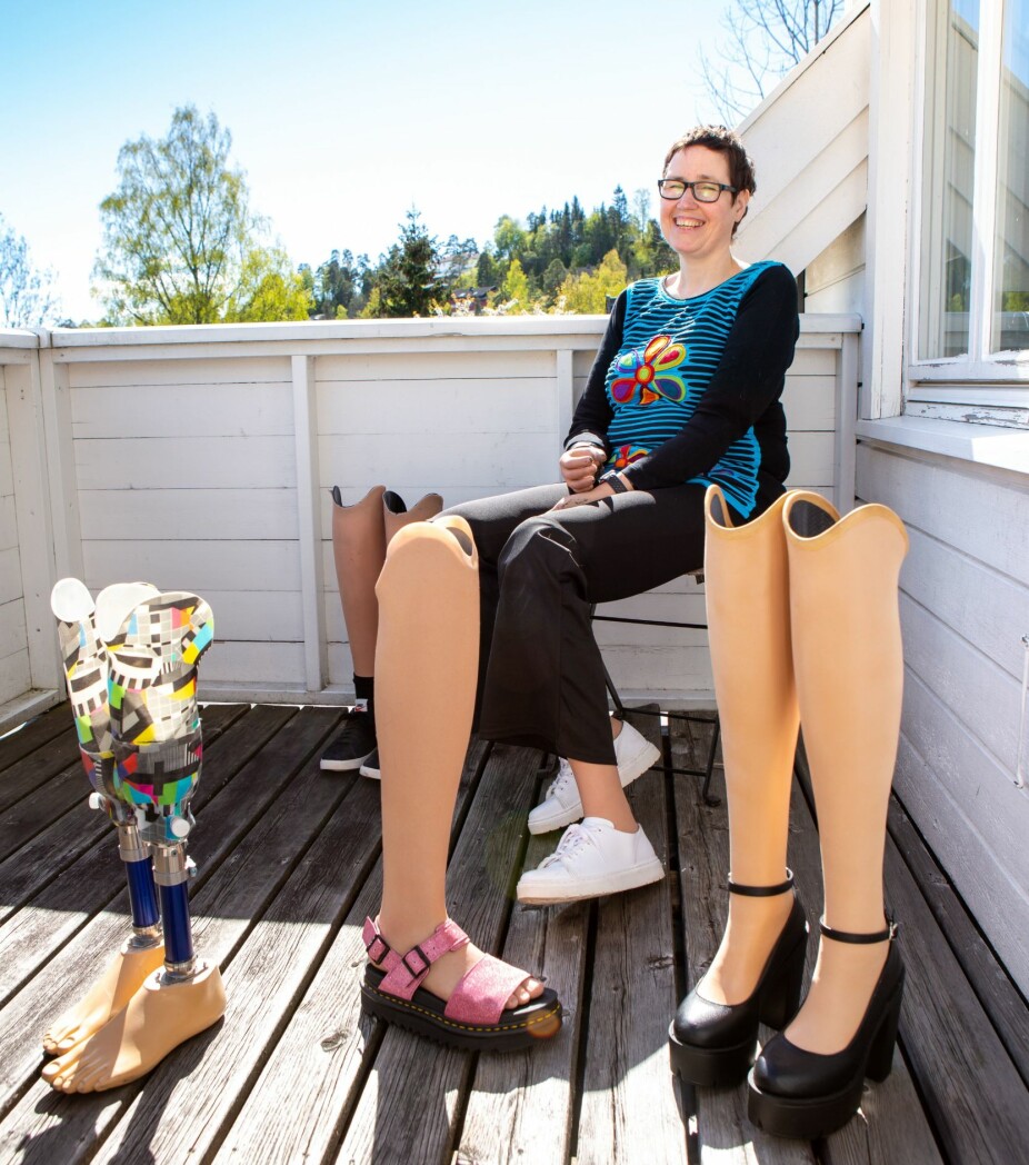 <b>MYE ØVELSE:</b> Det er hardt arbeid å lære seg å gå med proteser.