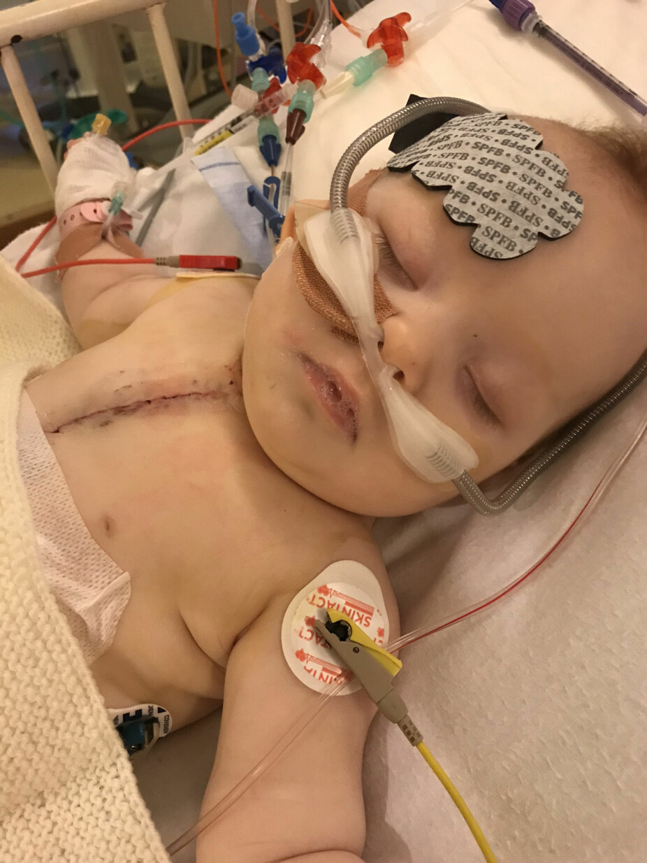 PÅ RIKSHOSPITALET: Marie er 4,5 måneder gammel, og har gjennomgått en vellykket hjerteoperasjon.
