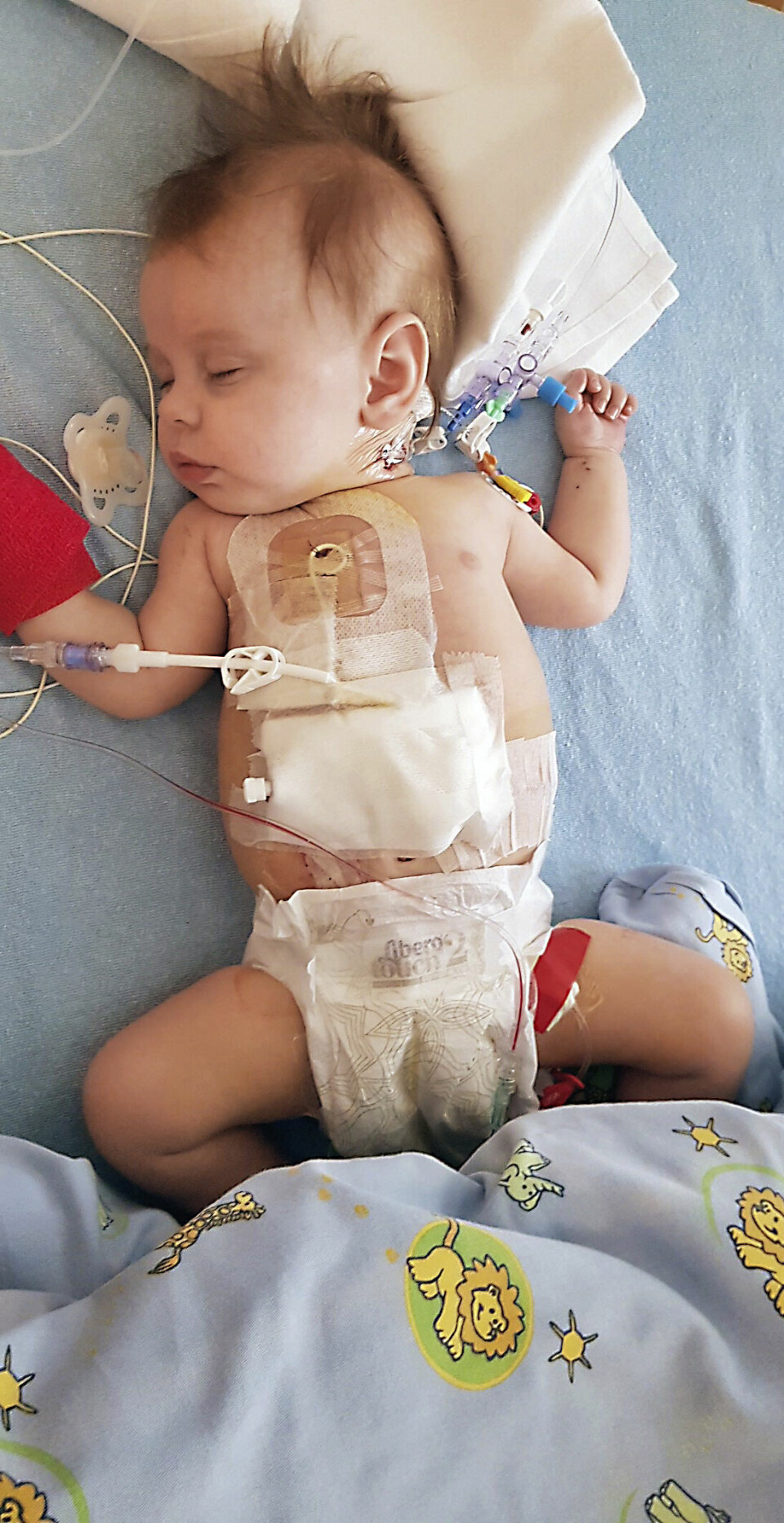 TØFFE TAK: Amine Isabella var innlagt på sykehus store deler av spedbarnstiden. Foreldrene var alltid med.