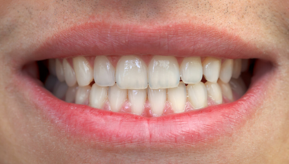 KAN BLI DYRT: Du bør oppsøke tannlege hvert år for å få sjekket at alt står bra til med tennene, råder farmasøyt.