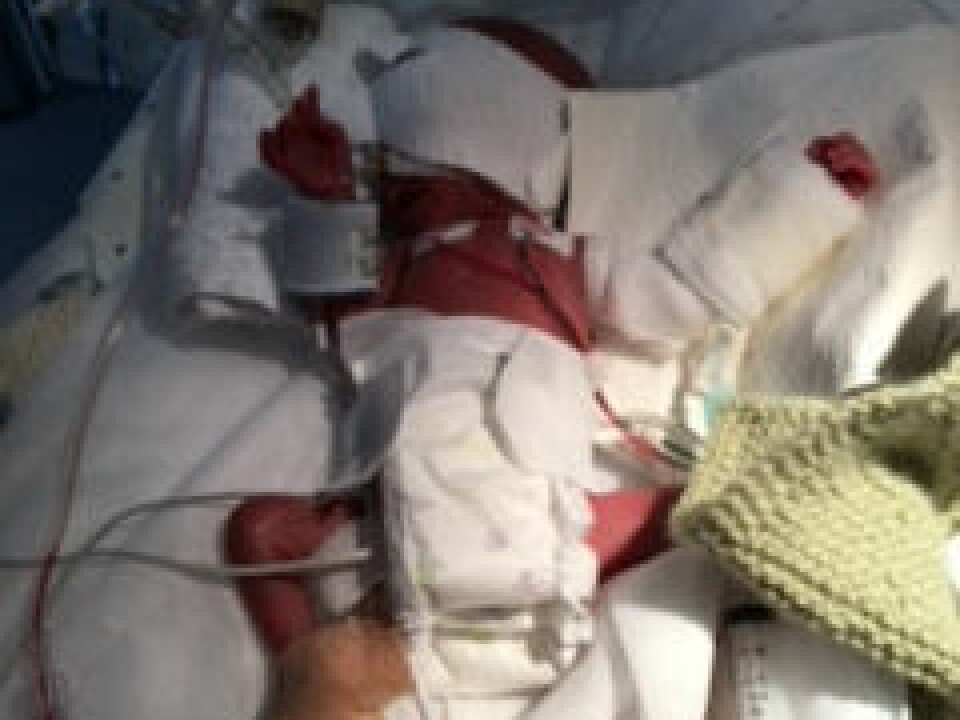 BITTELITEN: David veide bare 600 gram.