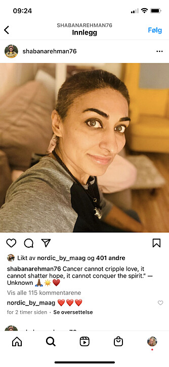<b>MISTET HÅRET:</b> Shabana publiserte nylig dette bildet av seg selv på Instagram. Det viste hva cellegiften hadde gjort med det flotte håret hennes.