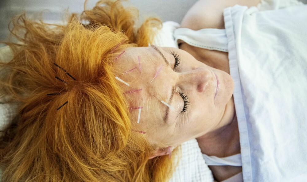 <b>LINDRER:</b> Jeanne Fairy får god lindring for sin tinnitus med akupunktur.