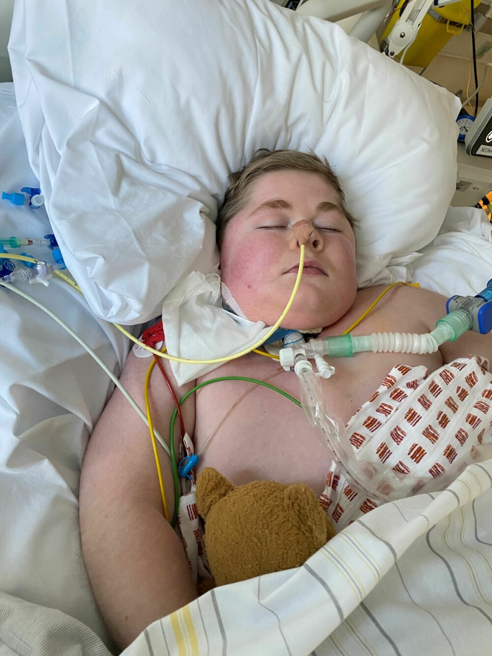 <b>DØDSSYK:</b> I desember i fjor ble Daniel tilkoblet respirator etter å ha blitt smittet av RS-virus. 