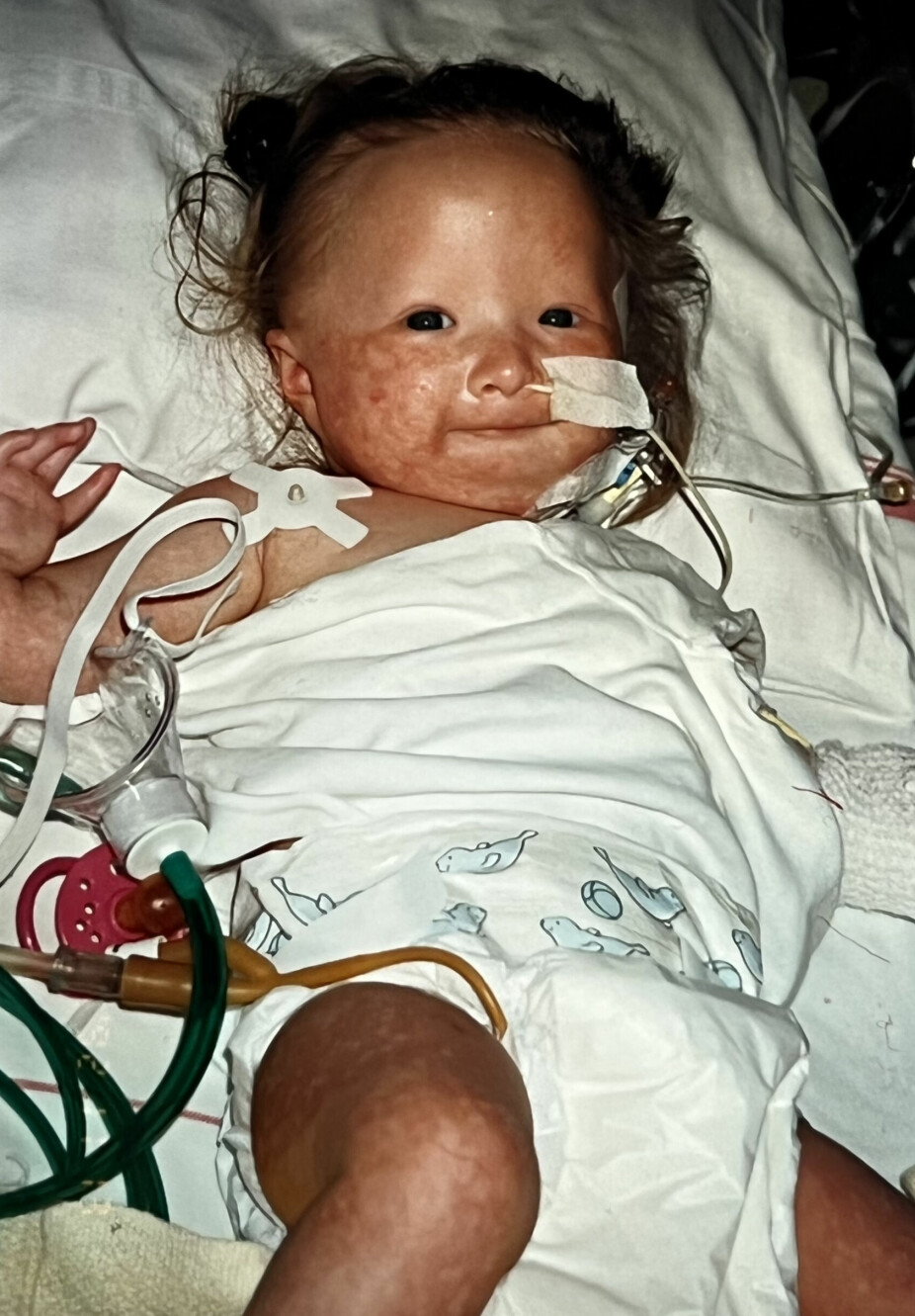 <b>KOMPLIKASJONER:</b> Victoria fikk en brå og komplisert start på livet da hun ble født med akutt keisersnitt i 1992.