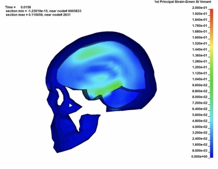 BRA HJELM: Dette er en skjermdump fra videoen av hjernen fra datastimuleringen. Denne illustrerer påkjenning på hjernen på det verste ved støt med en bra hjelm på. Støtet hadde en treffhastighet på 22 km i timen.