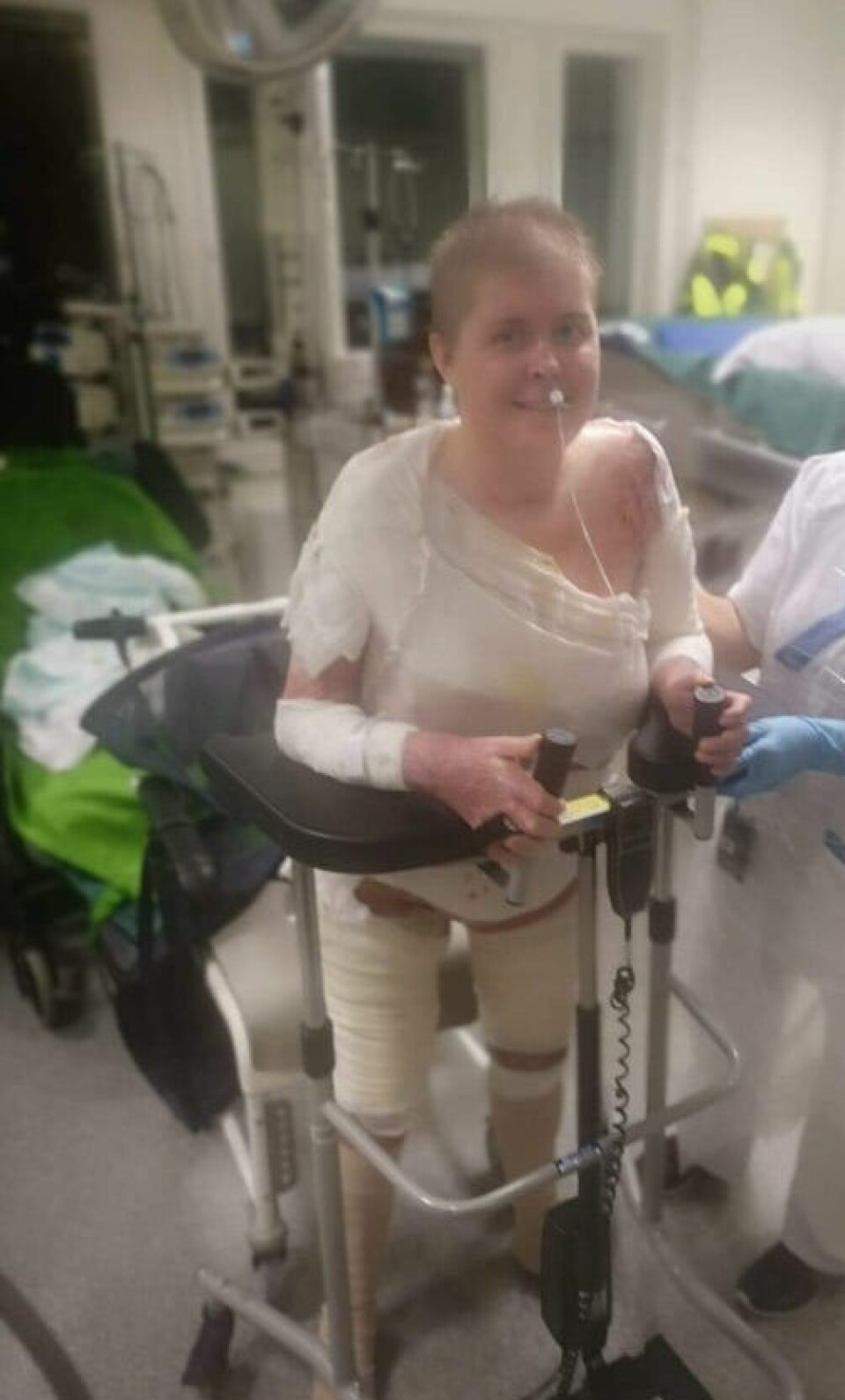 TØFF DAME: Rekonvalesensen var lang, men Emma sjokkerte alle ved å bli utskrevet fra sykehus et halvt år før legene hadde trodd.