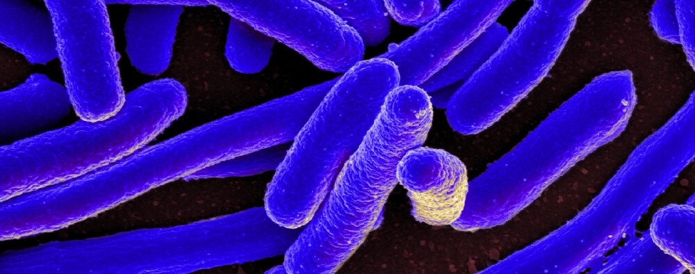 <b>SMÅ OG DØDELIGE:</b> Slik ser E. coli-bakterier ut i elektronmikroskop.