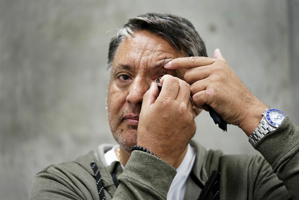 INN MED NYTT: Lynraskt og med øvede fingre setter Kenneth protesen på plass.