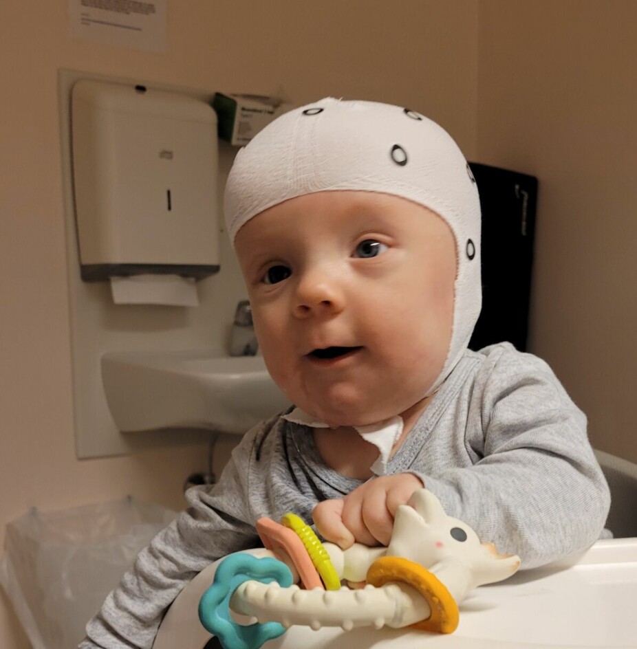 HJELM: Etter operasjon var barna nødt til å bruke hjelm 23 timer i døgnet i cirka ett år. Her er Storm klar for å scanne hode til ny hjelm.