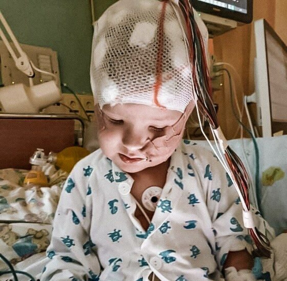 TØFF GUTT: Benjamin med EEG-måler på hodet.