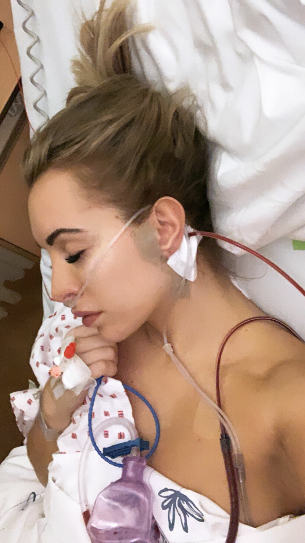 <b>SKREMMENDE OPPLEVELSE:</b> I 2019 måtte Carina gjennom en komplisert operasjon etter funn av en godartet cyste like under øret.
