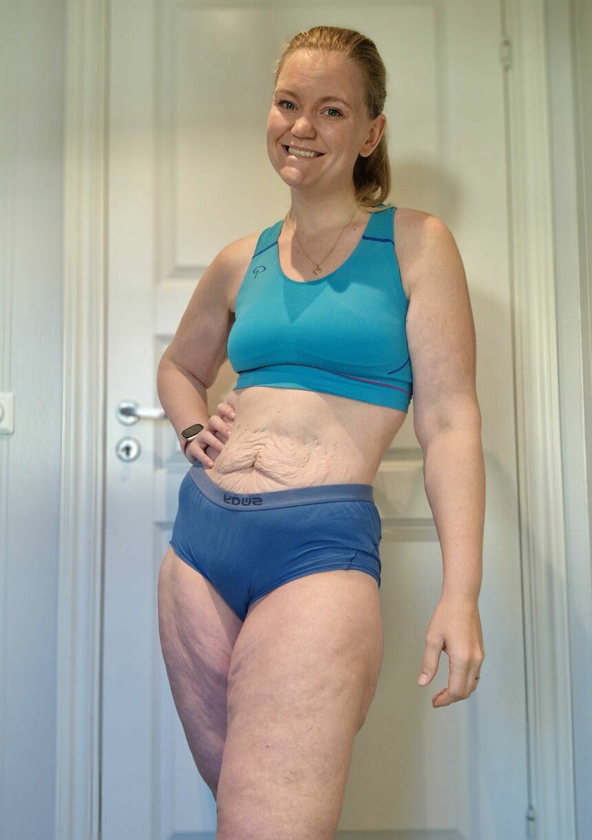 VEKTNEDGANG: Her har Elise gått ned 30 kilo. Bildet er tatt i oktober 2022.