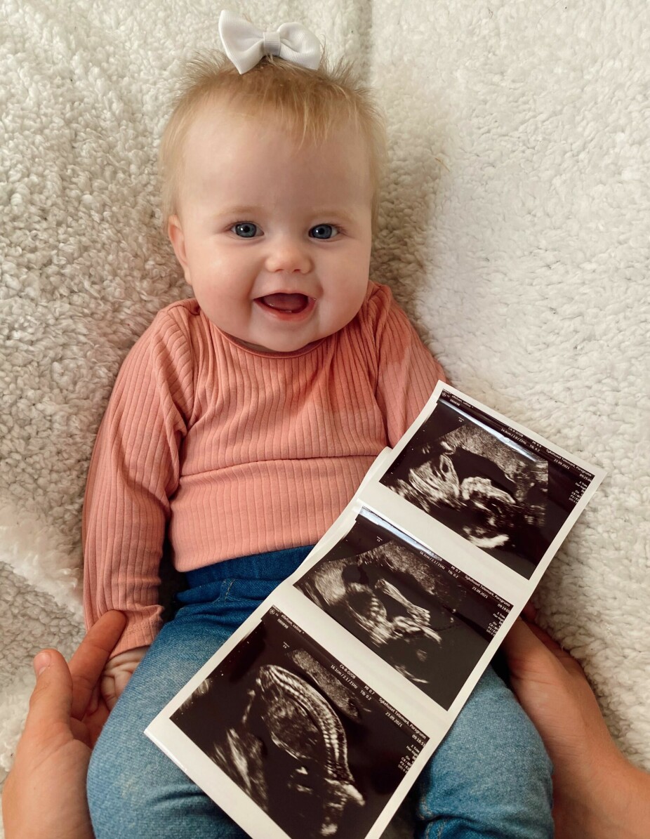 SVANGERSKAP: Celine ble gravid cirka 2 måneder etter at hun fikk sin førstefødte, Aurora. Hun fikk beskjeden da hun var cirka fem måneder på vei.