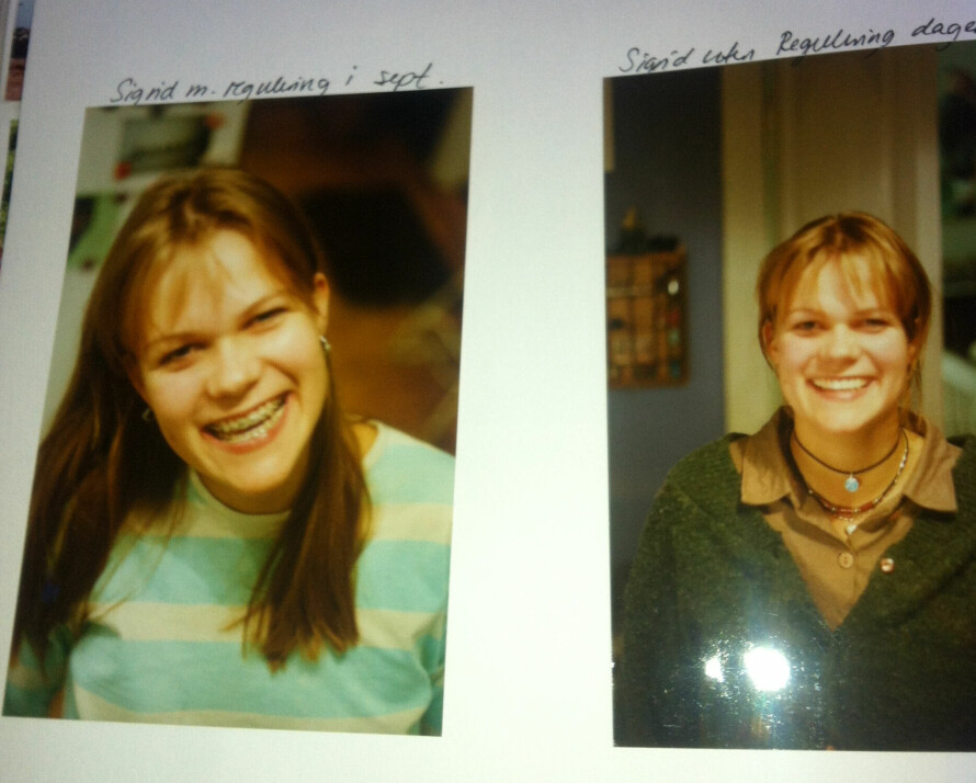 REGGIS: Sigrid hadde regulering i seks år! Her er det siste bildet av henne med regulering, og det første uten