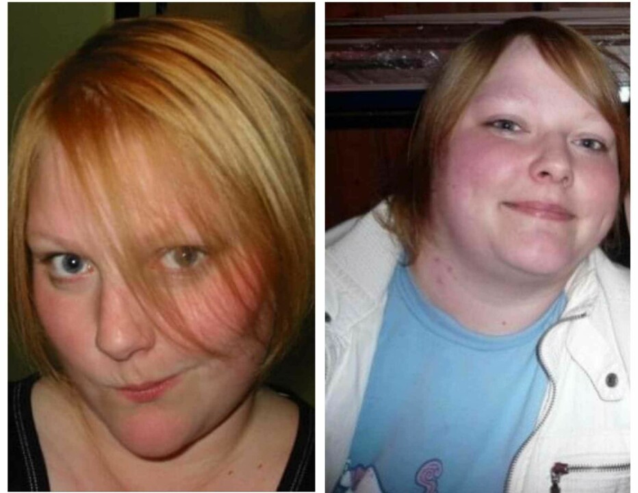KORTISON: Her er Anne-Stine før og etter livsreddende kortisonbehandling.
