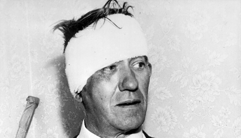 Offer: Lokfører Jack Mills måtte sy 14 sting i hodet, fikk varige mén og kom aldri tilbake i jobben.