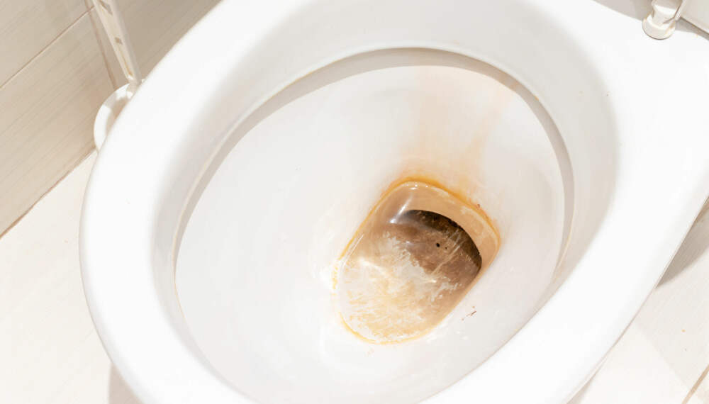 <b>BRUNT BELEGG I DO:</b> Dersom du slurver med toalettvasken eller bruker feil vaskemidler, kan det danne seg et ekkelt, brunt belegg nede i toalettskålen.