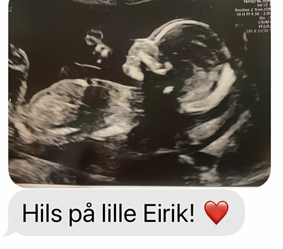 ULTRALYD: – Da vi fikk vite kjønnet på babyen, sendte vi denne hilsenen til mamma, forteller Erika.