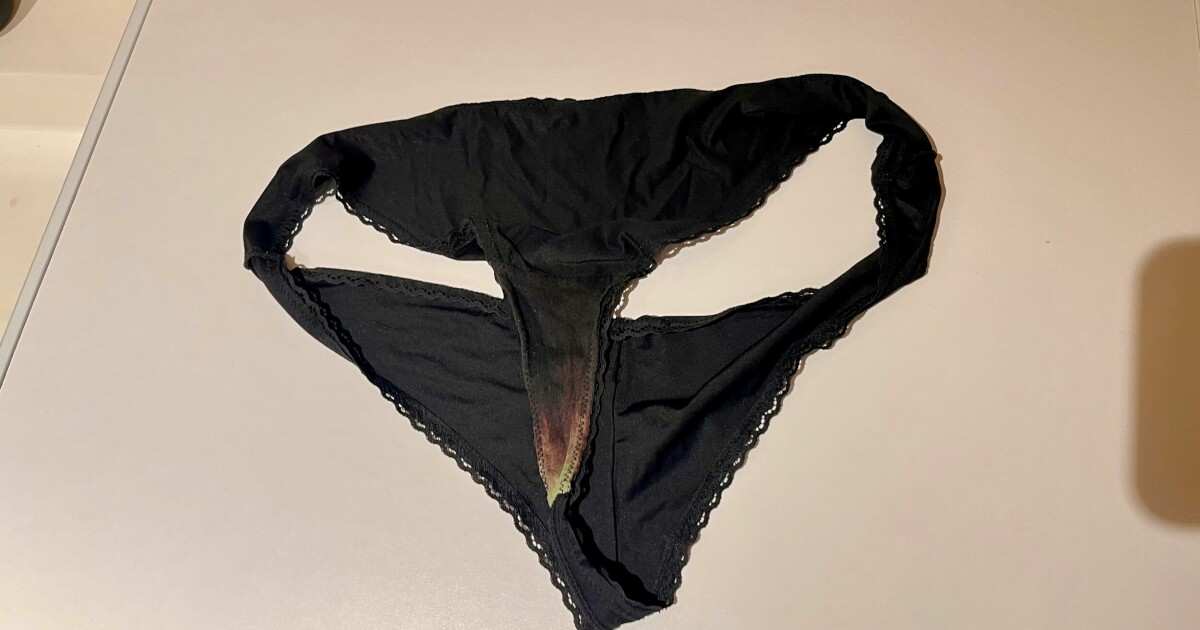 Derfor får du flekker i trusen Nei, det er ikke unormalt Helse