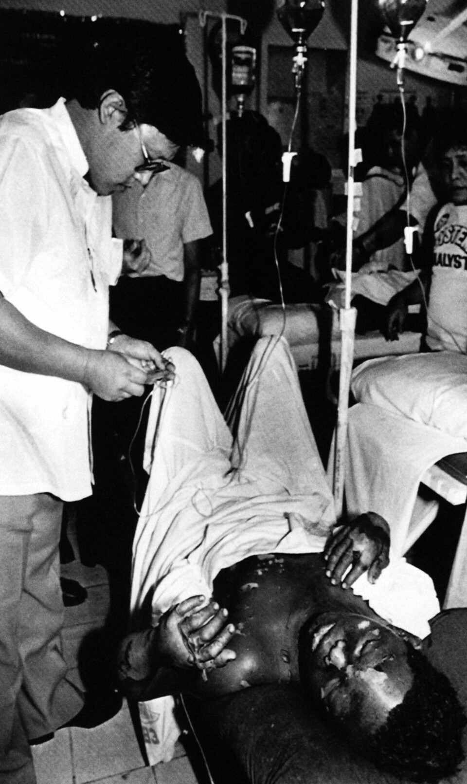 MIRAKEL: 21 år gamle Zosimo De La Rama ble tatt under behandling for tredjegrads forbrenninger etter å ha blitt reddet fra havet. Han var én av 26 overlevende fra det overfylte passasjerskipet.