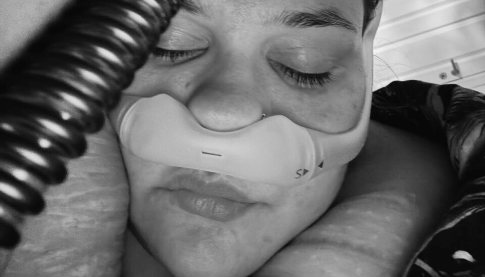 PUSTEHJELP: Her er Bella med CPAP-masken.