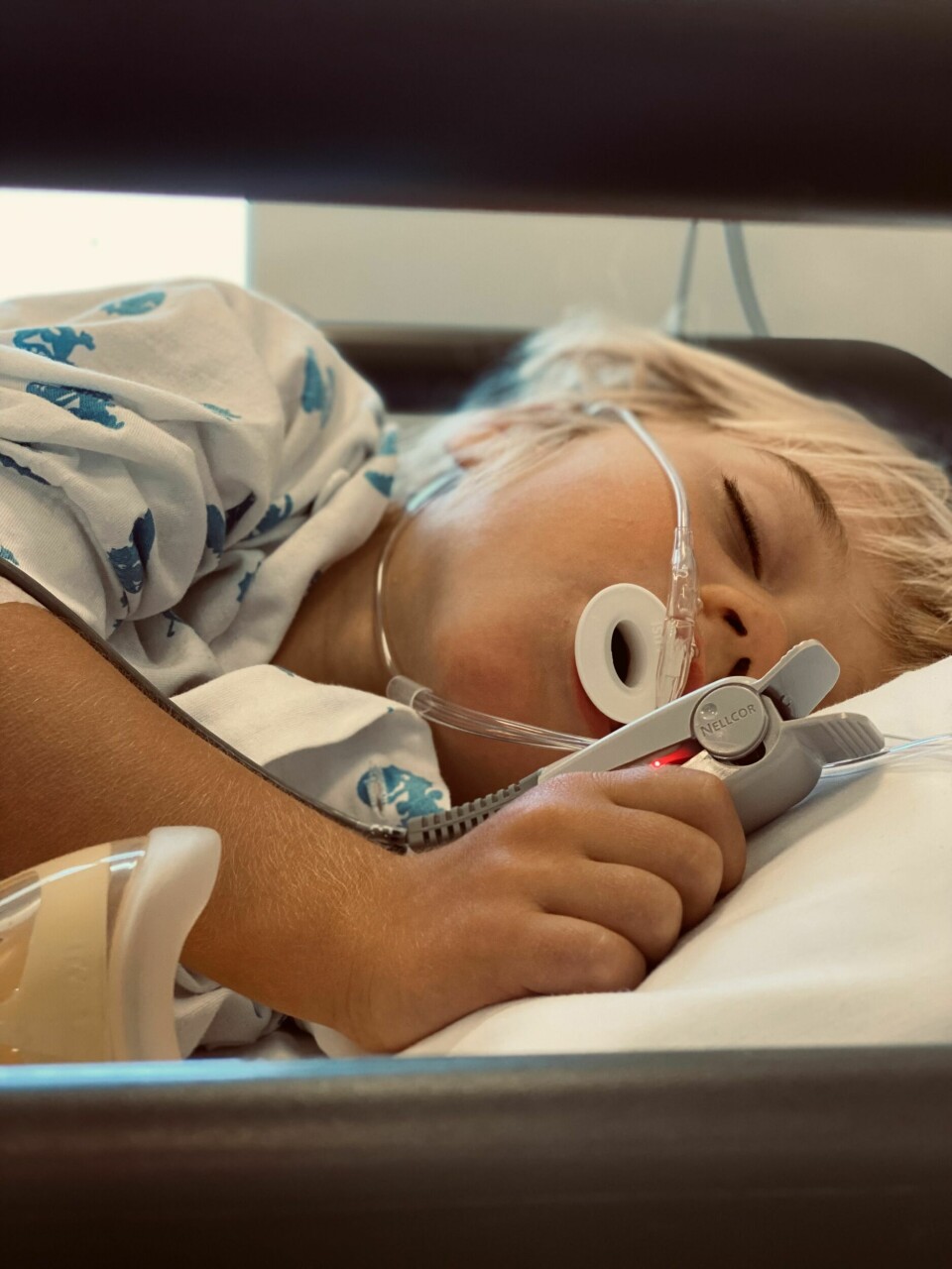 PÅ SYKEHUSET: Jonathan har tatt MR og spinalprøve i narkose i forbindelse med utredning av epilepsien.