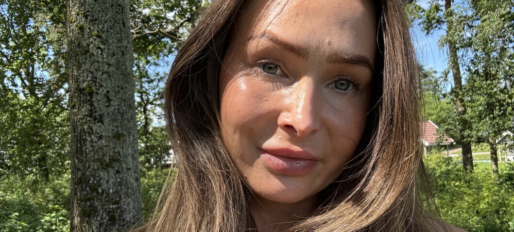 Johanne (33) rammet av sjelden sykdom: Botox ble redningen