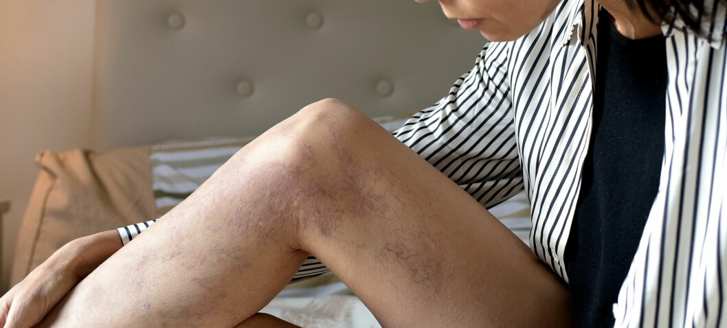 Derfor rammes kvinner oftere enn menn og dette kan du gjøre