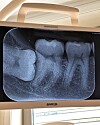 Digitalt tannrøntgenbilde av jeksler på Barco-skjerm i tannklinikk