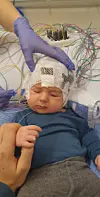 Spedbarn med hodeelektroder og mange ledninger ligger og sover i en sykehusseng.